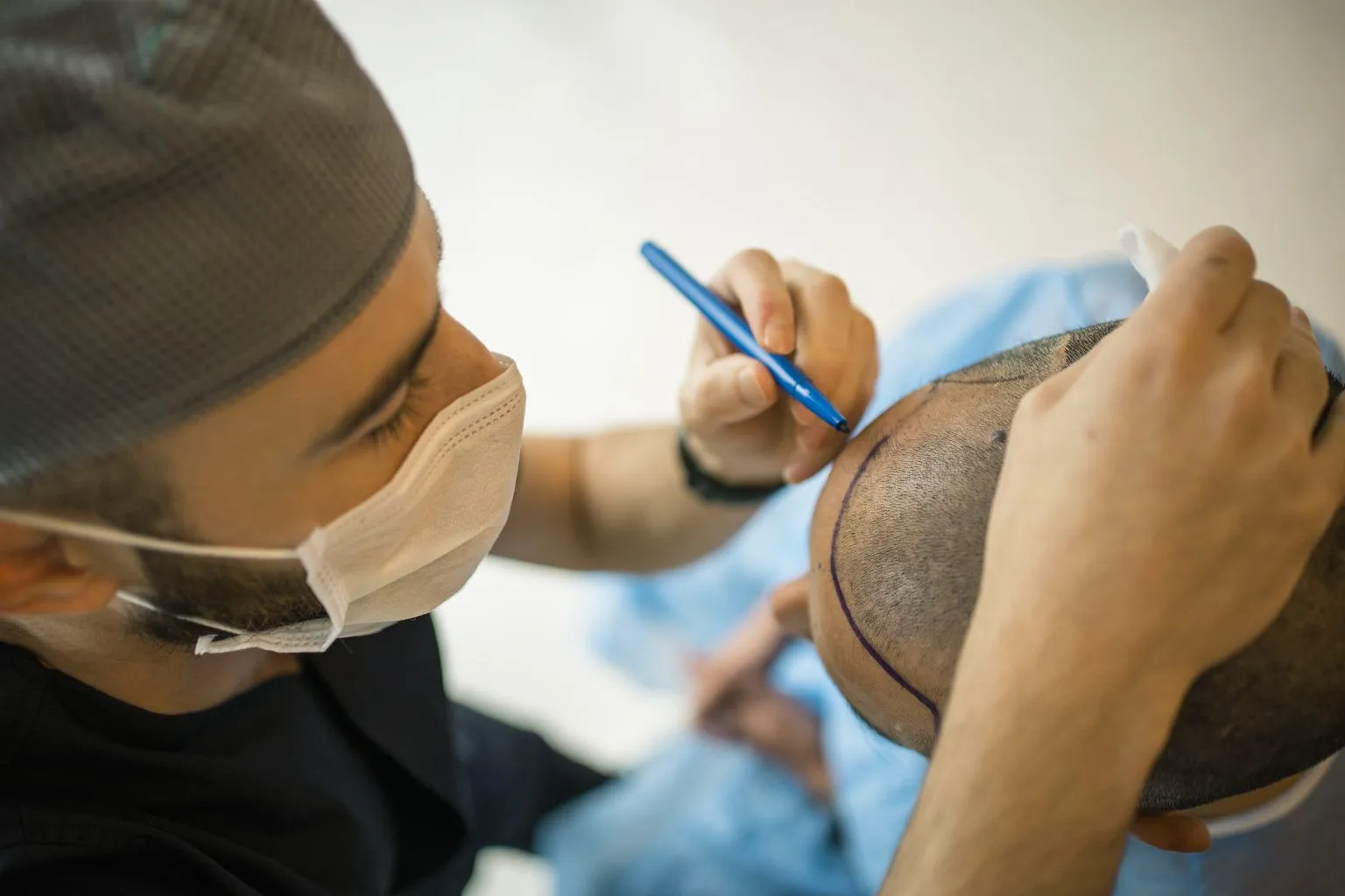 Best Hair Transplant Surgeon in Santa Barbara