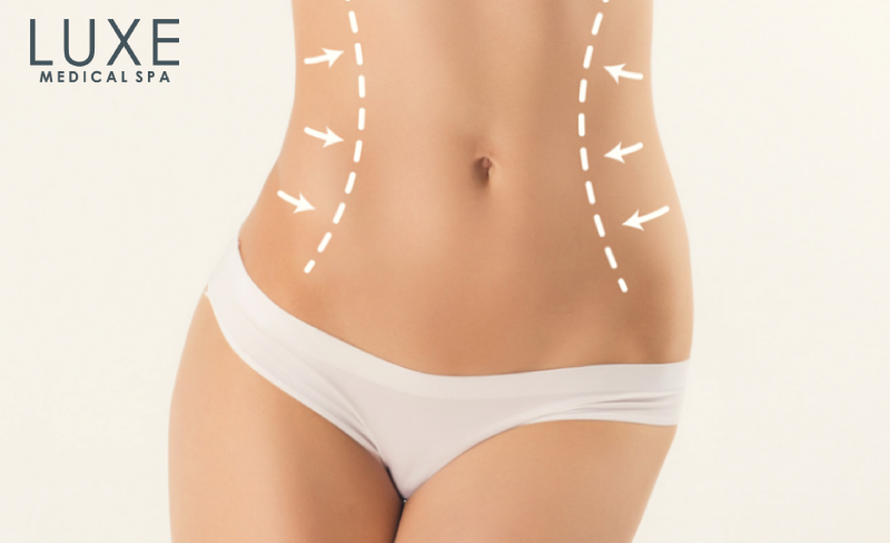 Liposuction Beverly Hills CA - Body Contouring Treatments