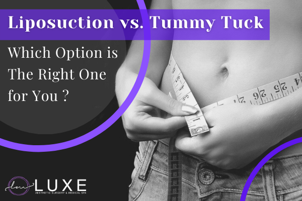 liposuction vs tummy tuck